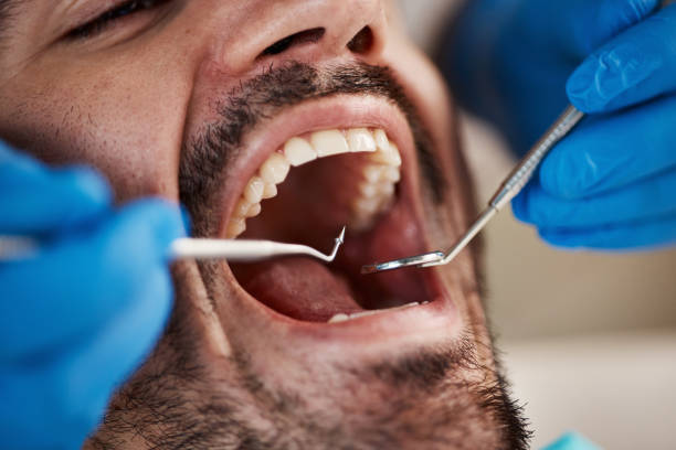 Best Walk-In Emergency Dentist in Claude, TX