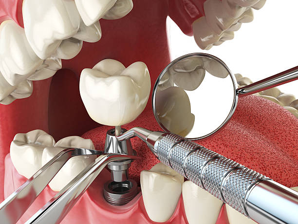 Best Emergency Treatment for Toothache in Claude, TX