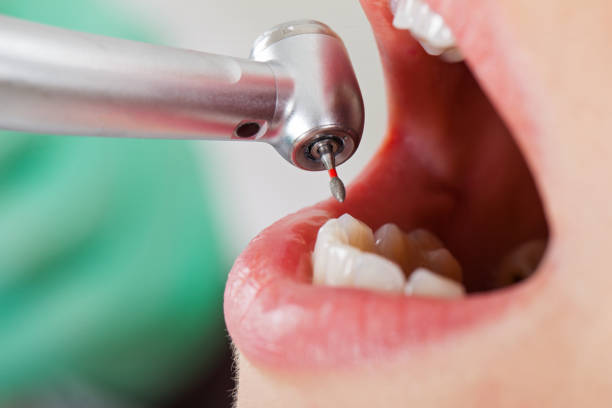 Best Emergency Treatment for Toothache in Claude, TX